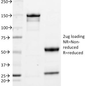 SDS-PAGE Analysis Purified IgA Mouse Monoclonal Antibody (HISA43). Confirmation of Purity and Integrity of Antibody.