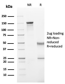 SDS-PAGE Analysis of Purified IgG Mouse Recombinant Monoclonal Antibody (rIG266). Confirmation of Purity and Integrity of Antibody.