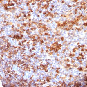 Formalin-fixed, paraffin-embedded human Tonsil stained with IgG Monoclonal Antibody (B33/20)