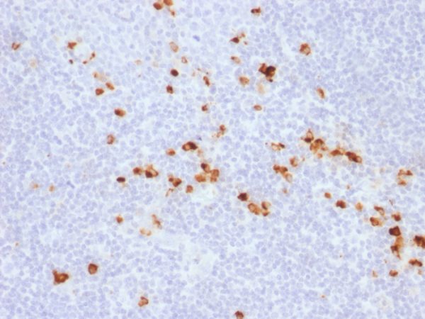 Formalin-fixed, paraffin-embedded human tonsil stained with IgG Rabbit Recombinant Monoclonal Antibody (IG507R).