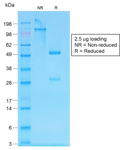 SDS-PAGE Analysis of Purified IgG Rabbit Recombinant Monoclonal Antibody (IG507R). Confirmation of Purity and Integrity of Antibody.