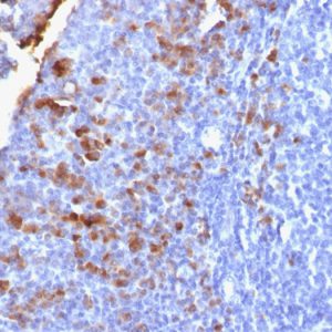 Formalin-fixed, paraffin-embedded human Tonsil stained with IgG Rabbit Recombinant Monoclonal Antibody (IG1707R).