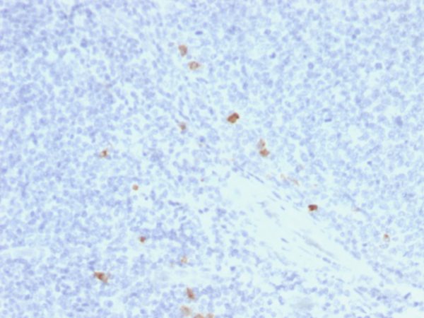 Formalin-fixed, paraffin-embedded human Tonsil stained with IgG4 Mouse Recombinant Monoclonal Antibody (rIGHG4/1345).