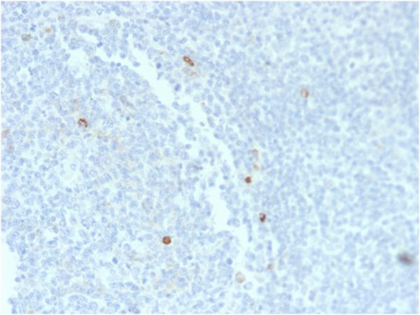Formalin-fixed, paraffin-embedded human Tonsil stained with IgM Mouse Recombinant Monoclonal Antibody (rIM373).