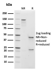 SDS-PAGE Analysis of Purified IgM Recombinant Mouse Monoclonal Antibody (rIGHM/1623). Confirmation of Purity and Integrity of Antibody.