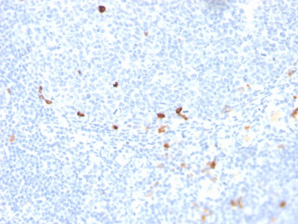 Formalin-fixed, paraffin-embedded human tonsil stained with IgM Recombinant Mouse Monoclonal Antibody (rIGHM/1623).