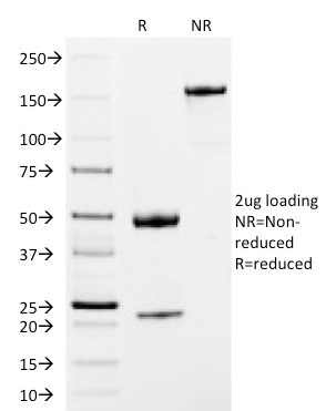 SDS-PAGE Analysis Purified IgM Mouse Monoclonal Antibody (IM373). Confirmation of Integrity and Purity of Antibody