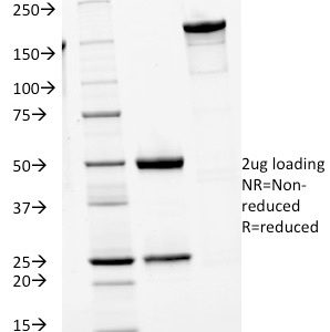 SDS-PAGE Analysis of Purified IgM Mouse Monoclonal Antibody (IGHM/1623). Confirmation of Purity and Integrity of Antibody.