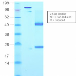 SDS-PAGE Analysis of Purified IgM Mouse Recombinant Monoclonal Antibody (rIGHM/2558). Confirmation of Purity and Integrity of Antibody.