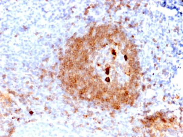 Formalin-fixed, paraffin-embedded human Tonsil stained with IgM Mouse Recombinant Monoclonal Antibody (rIGHM/2558).