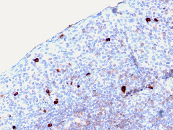 Formalin-fixed, paraffin-embedded human Tonsil stained with IgM Mouse Recombinant Monoclonal Antibody (rIGHM/2558).