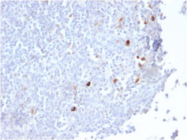 Formalin-fixed, paraffin-embedded human Tonsil stained with IgMRabbit Recombinant Monoclonal Antibody (IGHM/2559R).