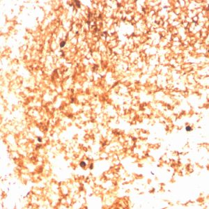 Formalin-fixed, paraffin-embedded human Tonsil stained with IgM Recombinant Rabbit Monoclonal Antibody (IGHM/3803R).