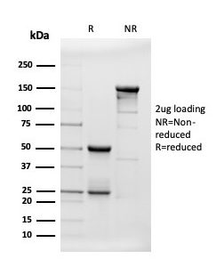 Antibody (APP/3343). Confirmation of Purity and Integrity of SDS-PAGE Analysis of Purified Beta Amyloid Mouse Monoclonal Antibody.