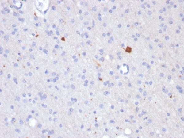 Formalin-fixed, paraffin-embedded human brain stained with Beta Amyloid Mouse Monoclonal Antibody (APP/3343).