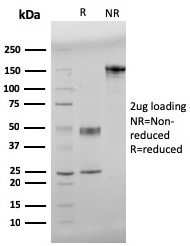 SDS-PAGE Analysis of Purified Beta Amyloid Mouse Monoclonal Antibody (APP/3345). Confirmation of Purity and Integrity of Antibody.