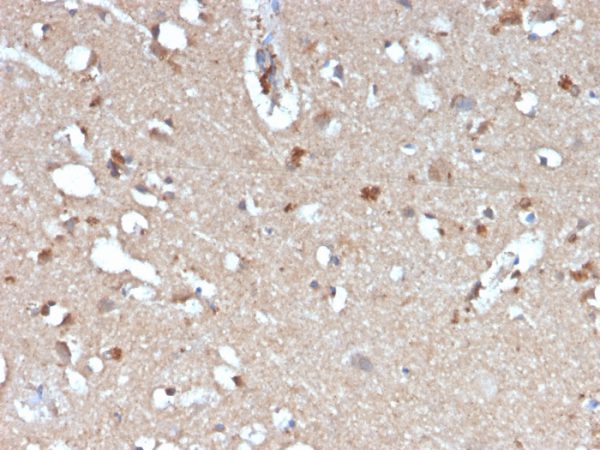 Formalin-fixed, paraffin-embedded human brain stained with Beta Amyloid Mouse Monoclonal Antibody (APP/3345).