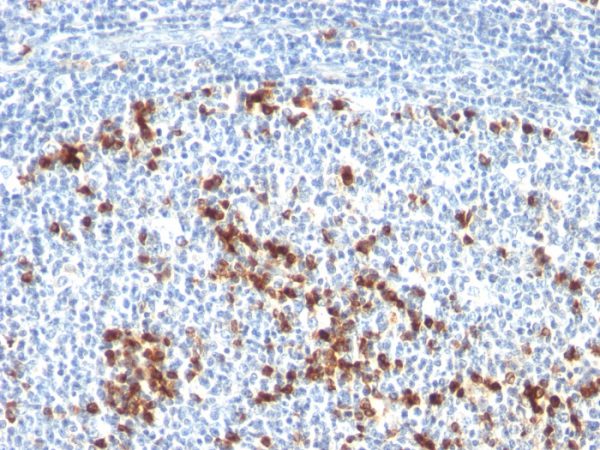 Formalin-fixed, paraffin-embedded human Tonsil stained with Kappa Light Chain Mouse Monoclonal Antibody (L1C1).