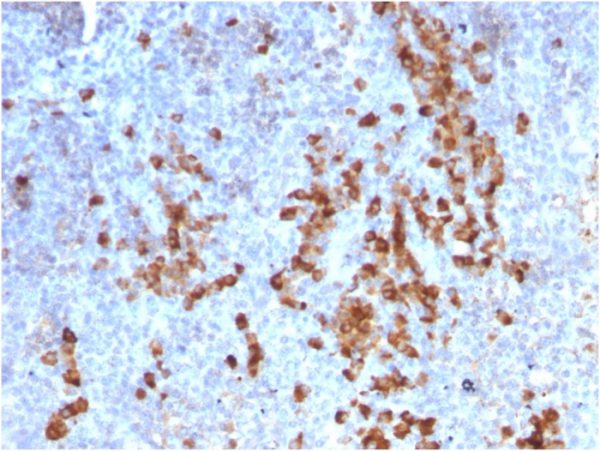 Formalin-fixed, paraffin-embedded human Tonsil stained with Kappa Light Chain Mouse Recombinant Monoclonal Ab (rKLC709).