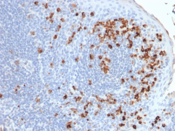 Formalin-fixed, paraffin-embedded human Tonsil stained with Kappa Light Chain Mouse Recombinant Monoclonal Antibody (rKLC264).