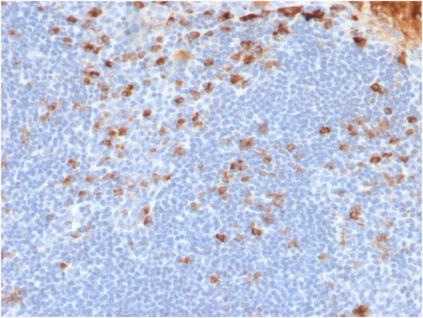 Formalin-fixed, paraffin-embedded human Tonsil stained with Kappa Light Chain Mouse Recombinant Monoclonal Antibody (rL1C1).