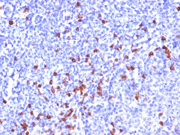Formalin-fixed, paraffin-embedded human Tonsil stained with Kappa Light Chain Monoclonal Antibody (SPM508).