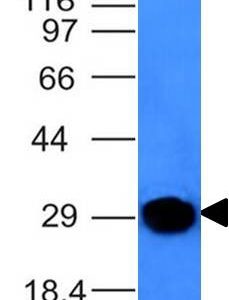 Western Blot Analysis of human Spleen lysate using Kappa Light Chain Mouse Monoclonal Antibody (KLC264).
