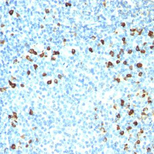 Formalin-fixed, paraffin-embedded human Tonsil stained with Kappa Light Chain Ab (SPM558).