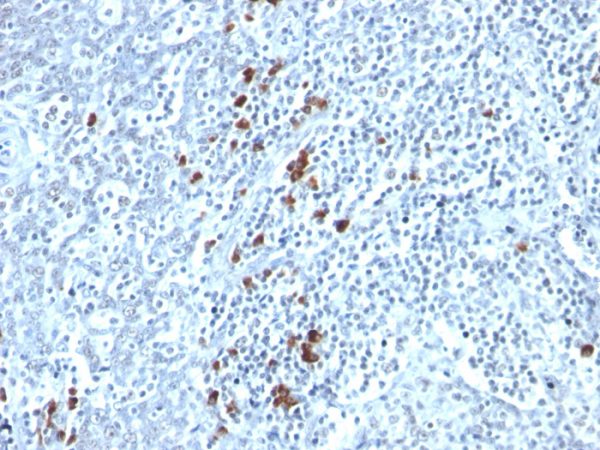 Formalin-fixed, paraffin-embedded human tonsil stained with Kappa Light Chain Monoclonal Antibody (TB28-2).