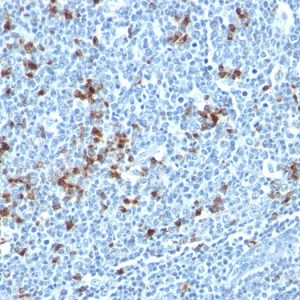Formalin-fixed, paraffin-embedded human Tonsil stained with Kappa Light Chain Mouse Monoclonal Antibody (HP6053 + L1C1).