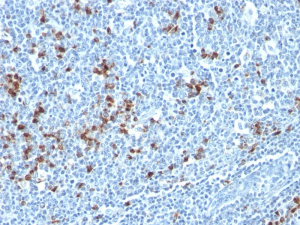 Formalin-fixed, paraffin-embedded human Tonsil stained with Kappa Light Chain Mouse Monoclonal Antibody (HP6053 + L1C1).