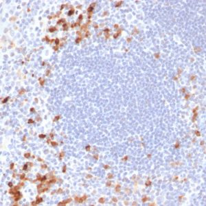 Formalin-fixed, paraffin-embedded human Tonsil stained with Kappa Light Chain Mouse Monoclonal Antibody (KLC709).
