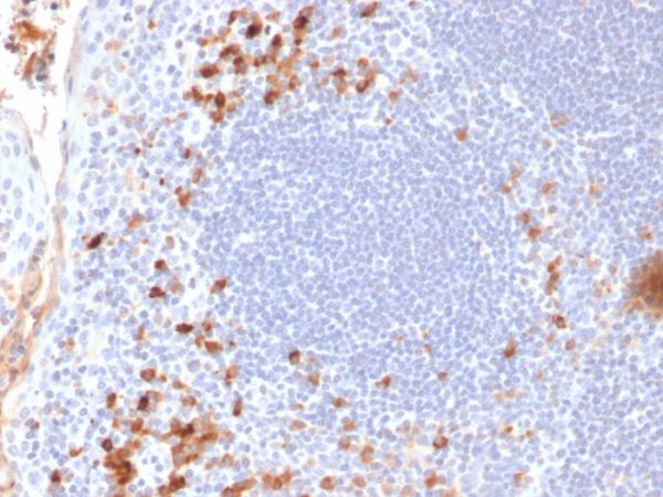 Formalin-fixed, paraffin-embedded human Tonsil stained with Kappa Light Chain Mouse Monoclonal Antibody (KLC709).