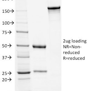 SDS-PAGE Analysis Purified Kappa Light Chain Mouse Monoclonal Antibody (KLC709). Confirmation of Purity and Integrity of Antibody.