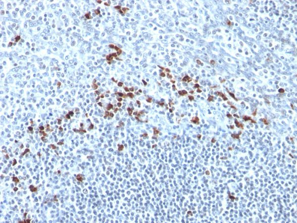 Formalin-fixed, paraffin-embedded human Tonsil stained with Kappa Light Chain Monoclonal Antibody (Kap-56).