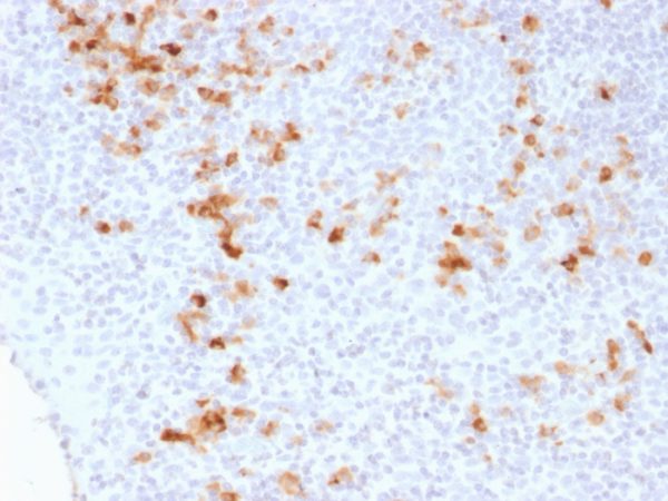 Formalin-fixed, paraffin-embedded human Tonsil stained with Kappa Light Chain Mouse Monoclonal Antibody (KLC1278).