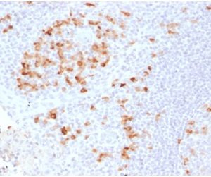 Formalin-fixed, paraffin-embedded human Tonsil stained with Kappa Light Chain Rabbit Recombinant Monoclonal (KLC2289R).