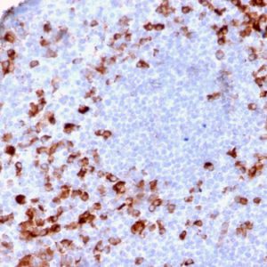 Formalin-fixed, paraffin-embedded human Tonsil stained with Kappa Lt. Chain Recombinant Rabbit Monoclonal Antibody (KLC/2886R).