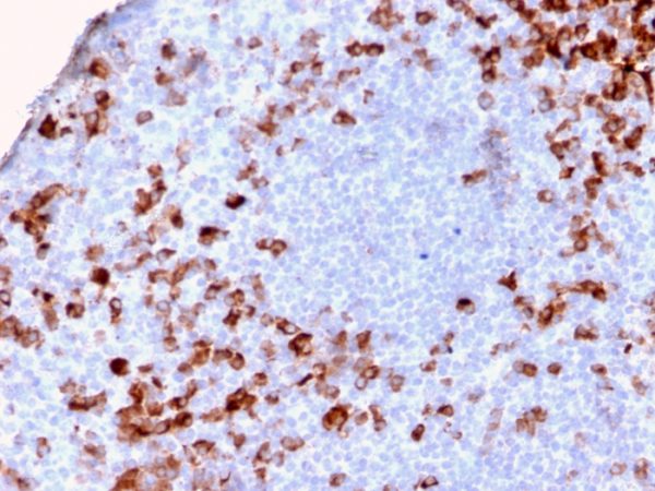 Formalin-fixed, paraffin-embedded human Tonsil stained with Kappa Lt. Chain Recombinant Rabbit Monoclonal Antibody (KLC/2886R).