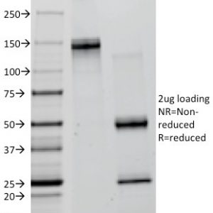 SDS-PAGE Analysis of Purified Lambda Light Chain Mouse Monoclonal Antibody (ICO-106). Confirmation of Integrity and Purity of Antibody.