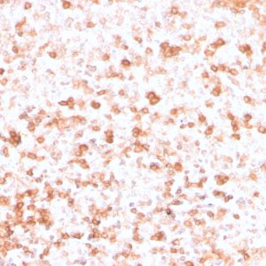 Formalin-fixed, paraffin-embedded human Tonsil stained with Lambda Light Chain Recombinant Mouse Monoclonal Antibody (rLLC/3777).