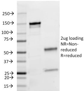 SDS-PAGE Analysis Purified Lambda Light Chain Mouse Monoclonal Antibody (HP6054). Confirmation of Integrity and Purity of Antibody