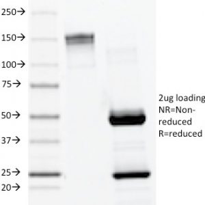 SDS-PAGE Analysis of Purified Lambda Light Chain Mouse Monoclonal Antibody (LAM03). Confirmation of Integrity and Purity of Antibody