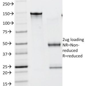 SDS-PAGE Analysis of Purified Lambda Light Chain Monoclonal Antibody (N10/2). Confirmation of Purity and Integrity of Antibody.