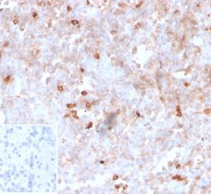 Formalin-fixed, paraffin-embedded human spleen stained with Lambda Lt. Chain Recombinant Mouse Monoclonal Antibody (rLLC/1738). Inset: PBS instead of primary antibody; secondary only negative control.