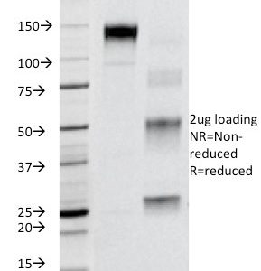 SDS-PAGE Analysis of Purified CD95 Mouse Monoclonal Antibody (B-R18). Confirmation of Purity and Integrity of Antibody.