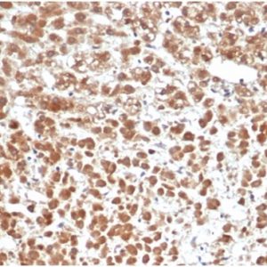 Formalin-fixed, paraffin-embedded human adrenal gland stained with Interleukin-1 Beta (IL-1B) Mouse Monoclonal Antibody (IL1B/6687)at 2ug/ml. HIER: Tris/EDTA, pH9.0, 45min. 2°C: HRP-polymer, 30min. DAB, 5min.