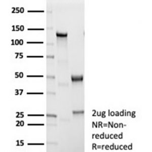 SDS-PAGE Analysis of Purified IL1B Recombinant Rabbit Monoclonal Antibody (IL1B/7049R). Confirmation of Purity and Integrity of Antibody.