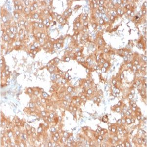 Formalin-fixed, paraffin-embedded human adrenal gland stained with Interleukin-2 (IL-2) Mouse Monoclonal Antibody (IL2/3950).