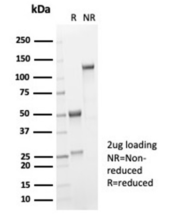 SDS-PAGE Analysis of Purified IL-2 Recombinant Rabbit Monoclonal Antibody (IL2/7051R). Confirmation of Purity and Integrity of Antibody.